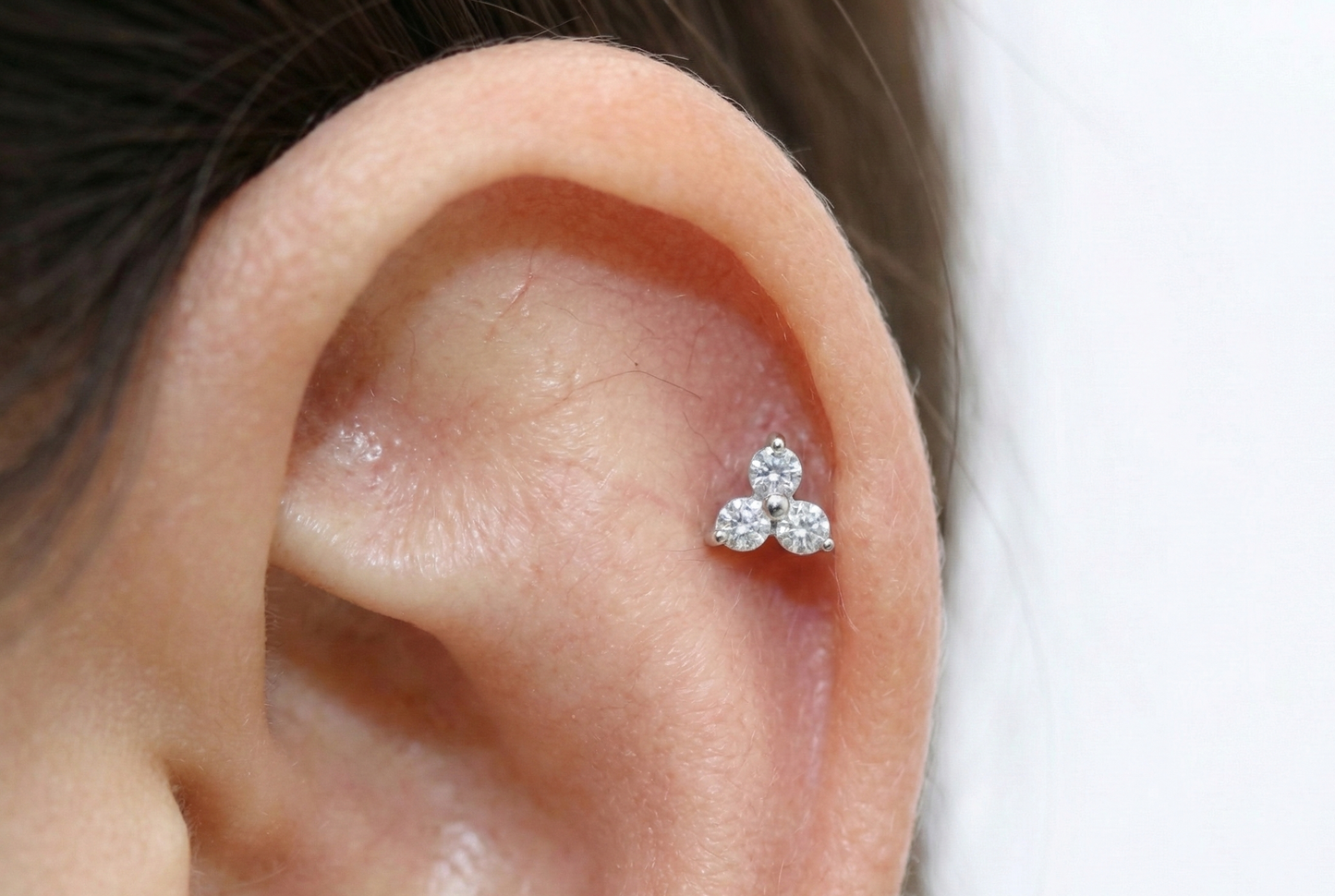 Tresillo zirconias Perforación